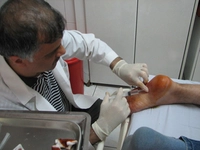 Topuk Dikeni Ameliyatı Riskleri ve Sonrası