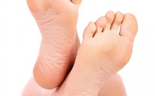 Topuk Kaşıntısı Neden Olur?